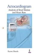 Actocardiogram: Analysis of Fetal Motion and Heart Rate image