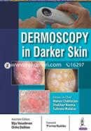 Dermoscopy in Darker Skin image
