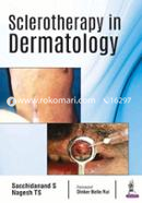 Sclerotherapy in Dermatology image
