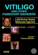 Vitiligo and Other Pigmentary Disorders image