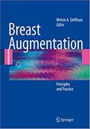 Breast Augmentation image