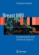 Breast MRI image