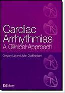 Cardiac Arrhythmias image