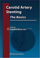 Carotid Artery Stenting image