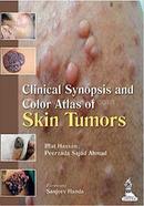 Clinical Synopsis And Color Atlas Of Skin Tumors image