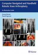 Computer Navigated and Handheld Robotic Knee Arthroplasty image