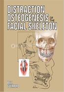 Distraction Osteogenesis of the Facial Skeleton image