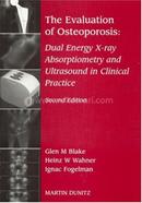 Evaluation Of Osteoporosis image