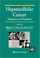 Hepatocellular Cancer: Diagnosis and Treatment image