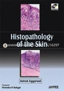 Histopathology of the Skin image