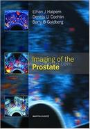 Imaging of the Prostate image