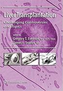 Liver Transplantation image