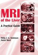 MRI of the Liver image