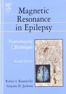 Magnetic Resonance in Epilepsy image