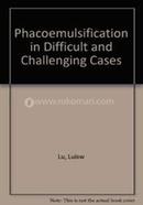Phacoemulsification in Difficult and Challenging Cases image