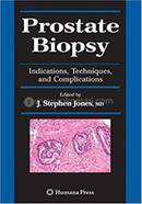 Prostate Biopsy image