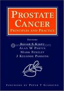 Prostate Cancer image