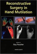 Reconstructive Surgery in Hand Mutilation image