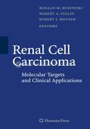 Renal Cell Carcinoma: Molecular Targets and Clinical Applications, Second Edition image