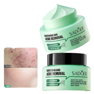 Sadoer Whitening Acne Removal Cream 50g Face Brightening image
