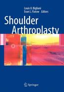 Shoulder Arthroplasty image
