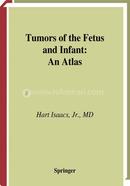 Tumors of the Fetus and Infant image