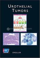 Urothelial Tumors image