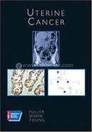 Uterine Cancer image