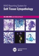 Who Reporting System for Soft Tissue Cytopathology: 4 image