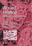 Wound Healing image