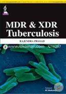 MDR and XDR Tuberculosis image