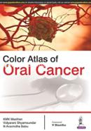 Color Atlas of Oral Cancer image
