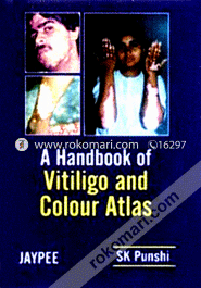 A Handbook of Vitiligo and Colour Atlas (Paperback) image