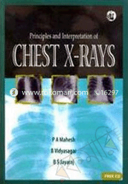 Principles and Interpretation of Chest X-Rays image