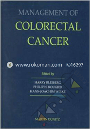 Management of Colorectal Cancer image