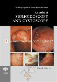 An Atlas of Sigmoidoscopy and Cystoscopy image