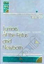 Tumors Of The Fetus And Newborn image