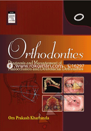 Orthodontics : Diagnosis And Management Of Malocclusion And Detofacial Deformities image