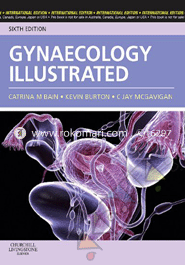 Gynaecology Illustrated image