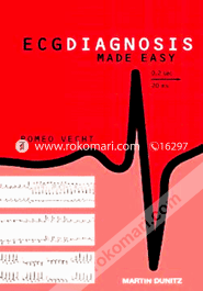 ECG Diagnosis Made Easy (Paperback) image