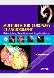 Multidetector Coronary CT Angiography image