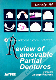 Review of Removable Partial Dentures (Paperback) image