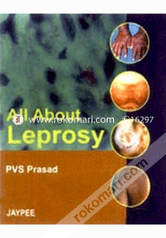 All About Leprosy image