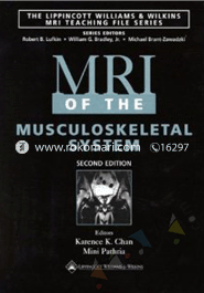 MRI of the Musculoskeletal System image