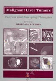 Malignant Liver Tumors image