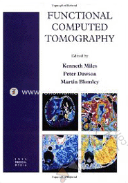 Functional Computed Tomography image