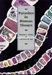 Parasites in Human Tissues image