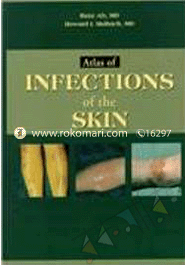 Atlas Of Infections Of The Skin image