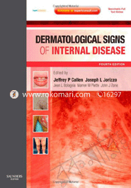 Dermatological Signs Of Internal Disease image