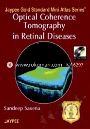 Optical Coherence Tomography In Retinal Diseases image